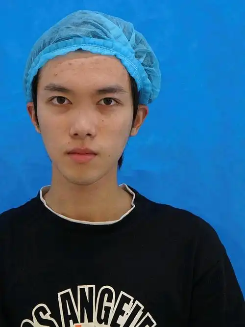 塌鼻子男生如何自救