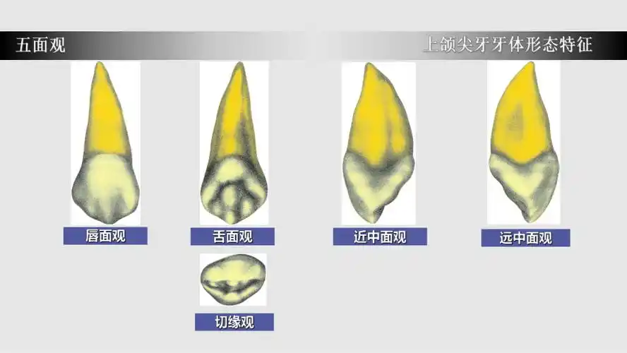 上颌尖牙牙体形态简述8ppt学习课件
