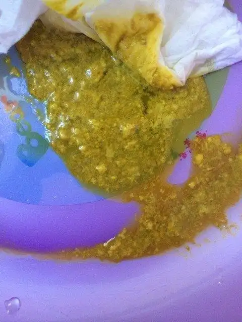 宝宝3个月13天,奶粉喂养,这几天又有点像月子里拉的大便,拉肚子似的