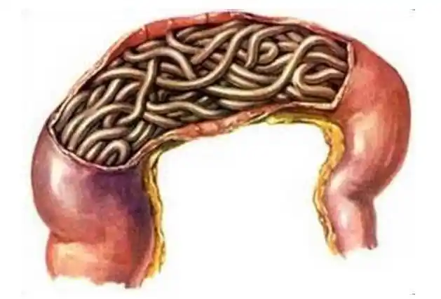 小孩总是半夜磨牙医院检查发现肚子里有寄生虫这些情况要注意