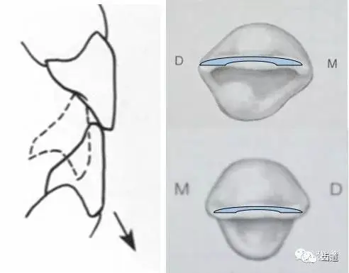 (1)切嵴牙合面切嵴切缘和牙合面形态的生理意义1