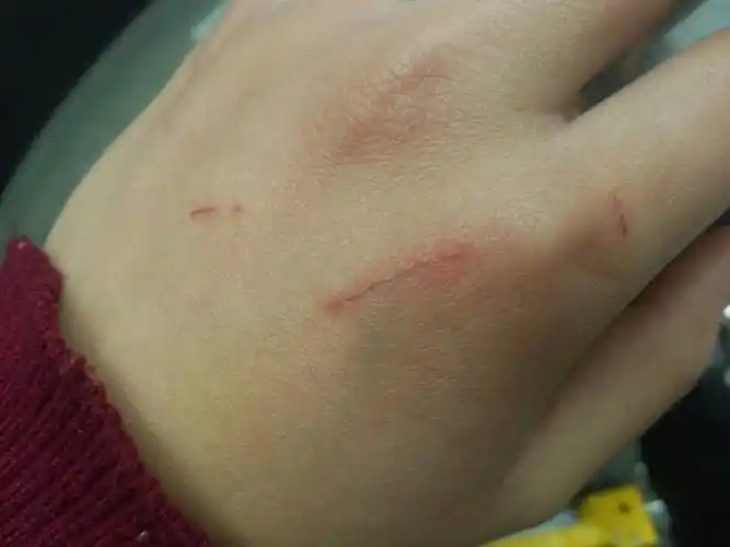 被狗狗抓伤了可不可以不打针.伤口不深出了点血