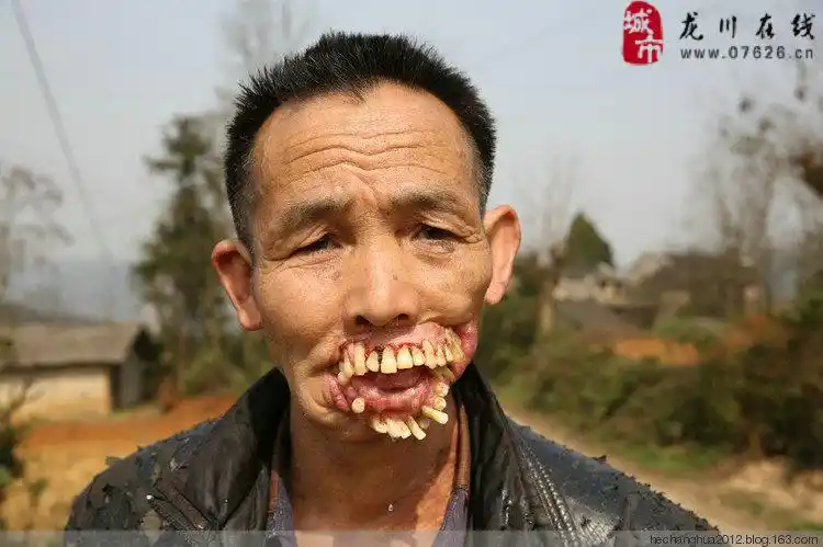 被狼"舔"过的嘴巴