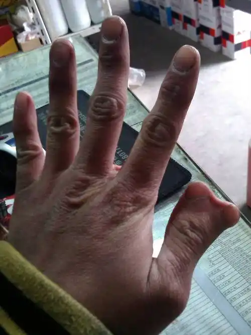 印度明星的手是六指