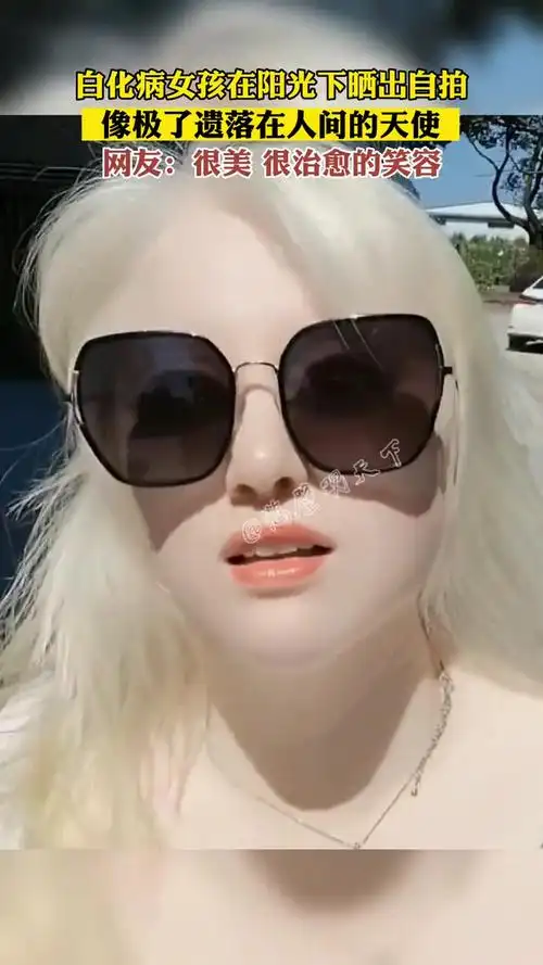 浙江 白化病女孩在阳光下晒出自拍 像极了遗落在人间的天使