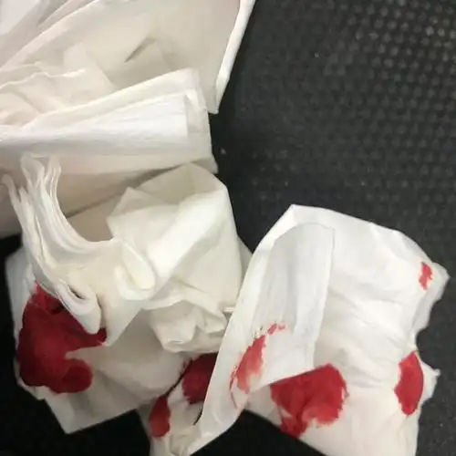 13:34:16 1101yes 大好人 我爱你我就是正打算请流鼻血 删除| 赞回应