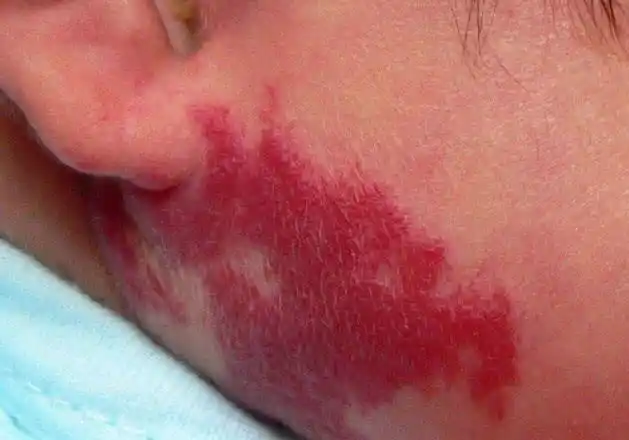 怀孕后, 宝妈尽量不要做的几件事, 不然宝宝生出来可能有胎记