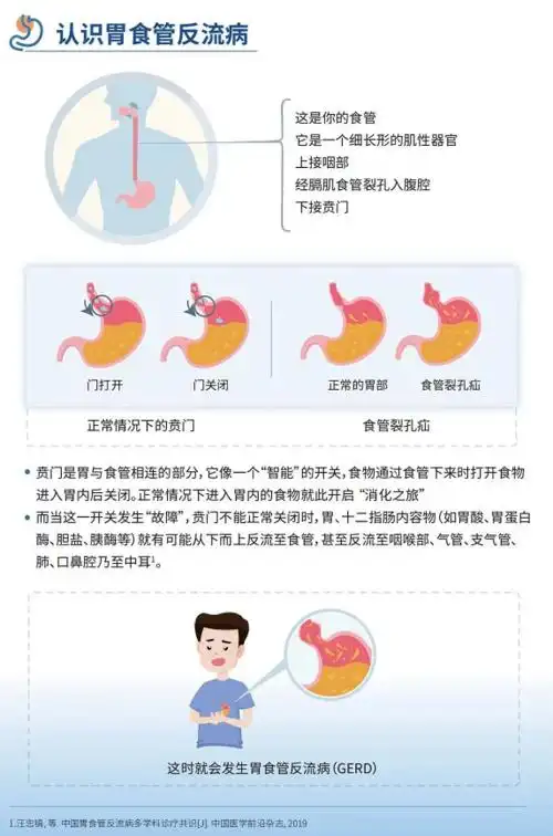健康科普2021年10月18日24日是第四届"全国胃食管反流病宣传周",今年