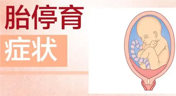 胎停了孕妈妈会有哪些症状呢