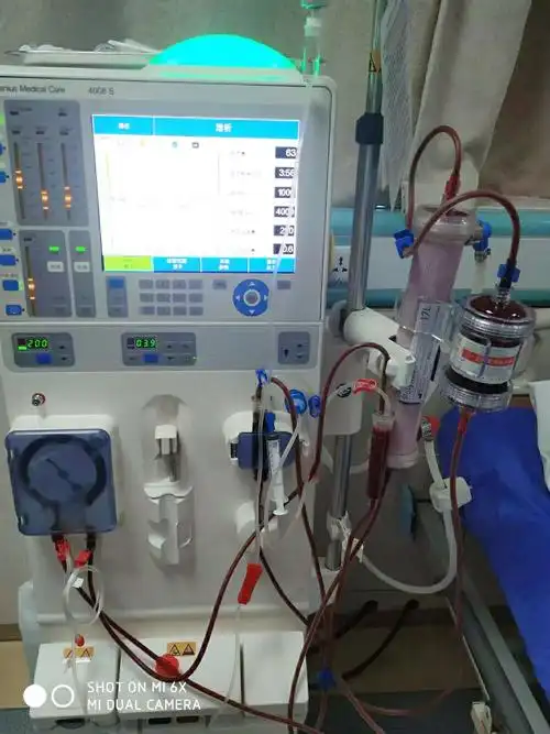 我院血液透析室又添新设备——5008s血液透析滤过机顺利投入使用