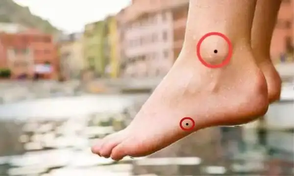 脚上痣的命运吉凶哪颗痣劳碌奔波哪颗痣名利双收