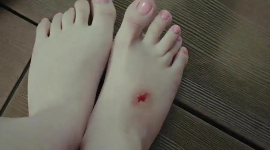 女孩的脚划破一个口子,皮肤竟瞬间老化
