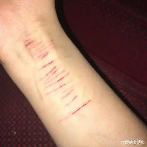 许多学生用刀自残