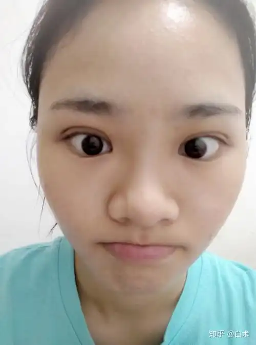 可以看看小姐妹们内双割的双眼皮的照片吗? - 知乎