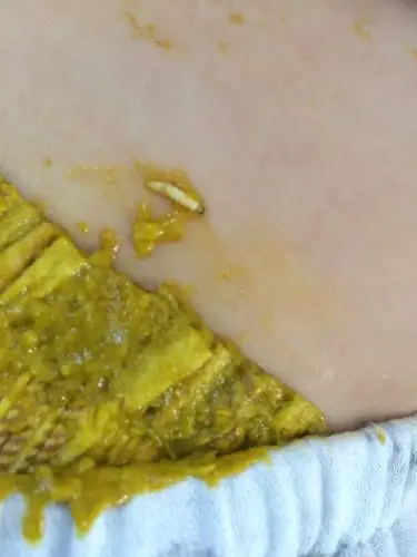 33333  推荐回答 这个是看不出来的,最好要拿着大便到医院去化验的