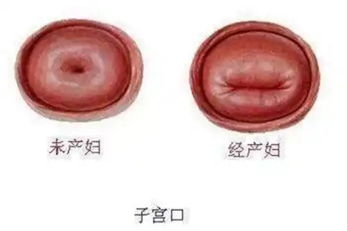 女性子宫"使用过",这些特征很明显,医生轻易就能看出