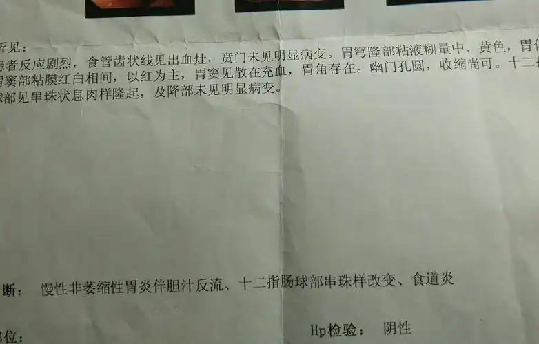 如何根治慢性胃炎天天胃胀已两年胃中食物不能及时消化胃