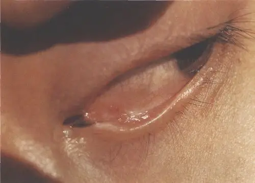 眼前节疾病图谱·眼眶手术彩色图谱·斜视诊疗图谱·眼耳鼻咽喉科