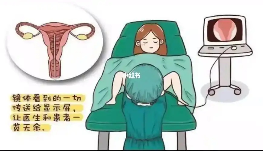 谢晖亮  #备孕上海宫腔镜一哥是谢晖亮,本来都决定去乐仁找谢手术肆