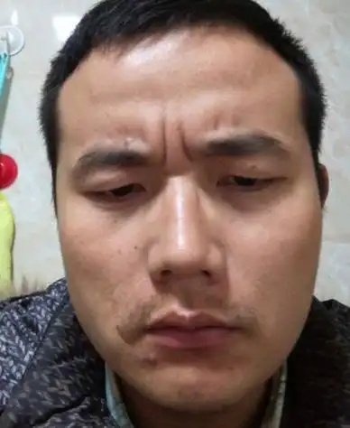 而额头的面相也是非常重要的,就比如有的女人印堂上长有八字纹,那么