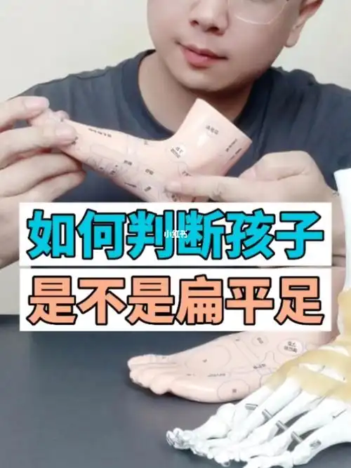 快来测测你家孩子是不是真正的扁平足