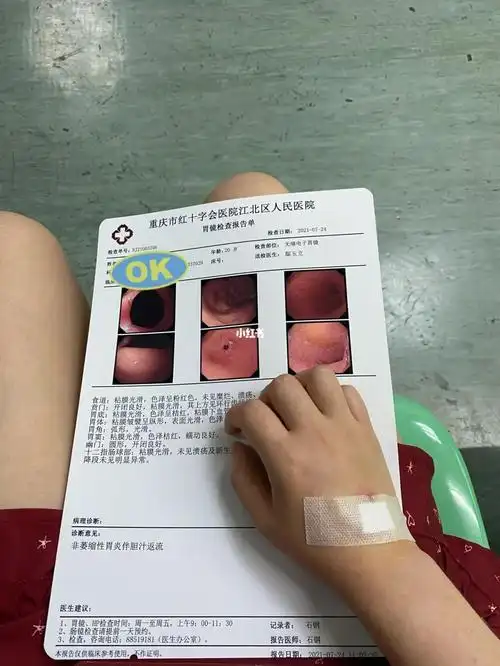 无痛胃镜是真的好!