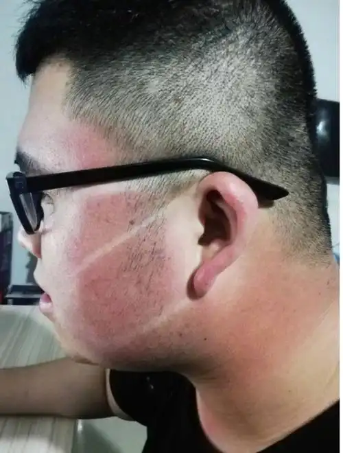 交警被晒成口罩脸##容易被晒黑是什么体验