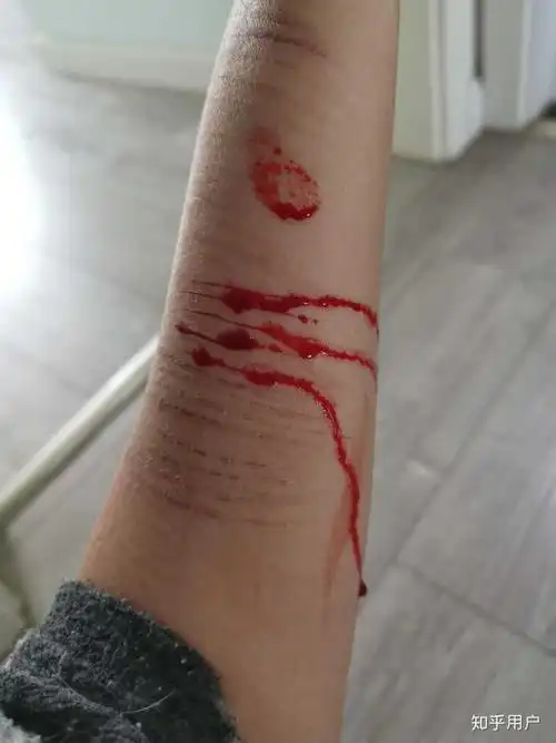自残的人真的很令人讨厌吗?