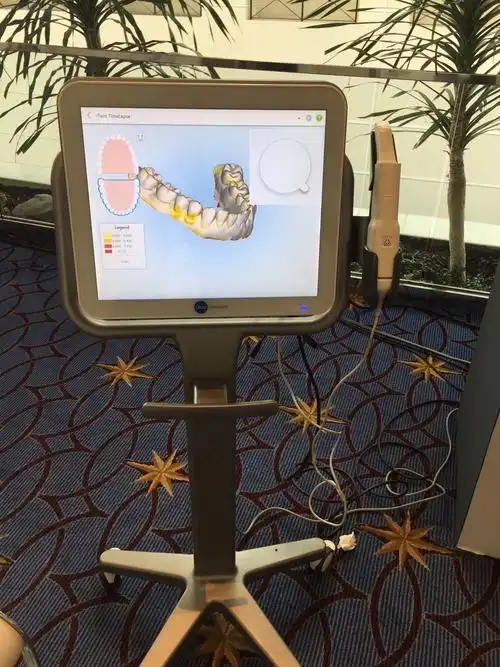 itero新科技即将在5月11日正式上线敬请期待