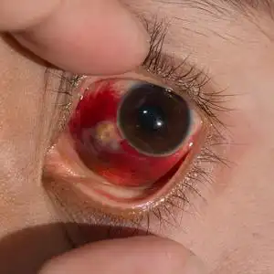 光眼子眼睛考试照片