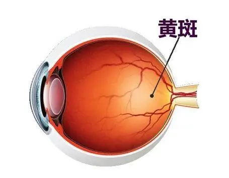 黄斑疾病介绍_黄斑病 - 好大夫在线