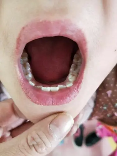 榆能化园区幼儿园 育儿小知识 第一期:我们的牙齿