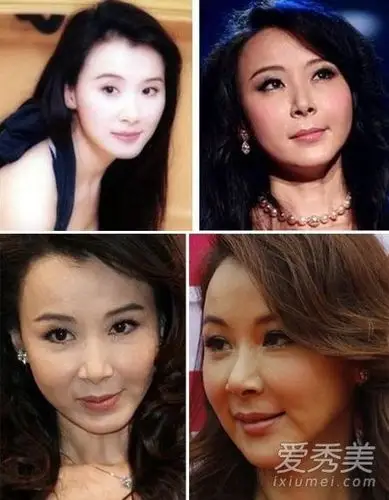 相爱穿梭千年郑爽美丽但颜僵 到底女星整容后遗症容谁更惨?