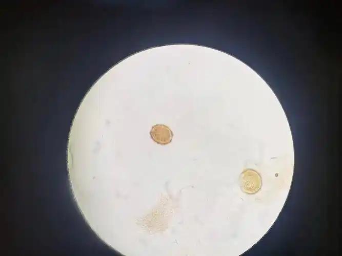 人体寄生虫学线虫