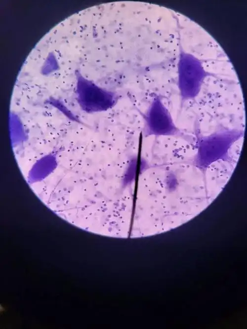 一些显微镜照片,估计你没见过!