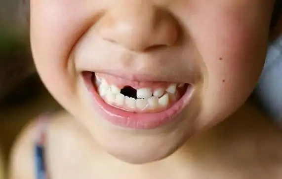 原创宝宝乳牙关键时能"救命"?但远不止把乳牙保存那么简单