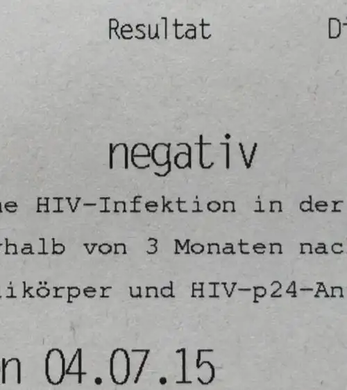 我自己的化验单:阴性