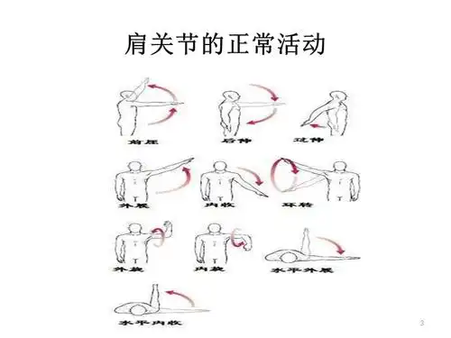 肩关节周围炎病人ppt课件