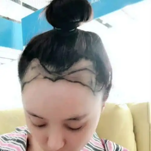 m型发际线女孩绝不认输!