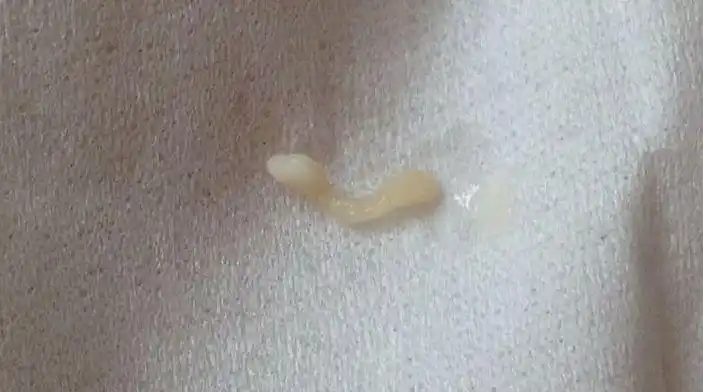 草,传不了图片啊,这是什么虫子啊,白色的,狗身上掉下来的,很小,像小