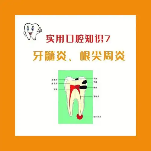 牙髓炎  #急性牙髓炎  #根尖周炎  #慢性根尖周炎  #牙根尖周炎
