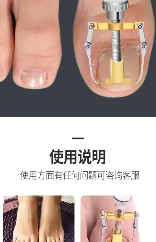 甲沟炎专用剪刀套装嵌甲矫正器德国修脚刀家用灰厚脚趾甲刀鹰嘴钳