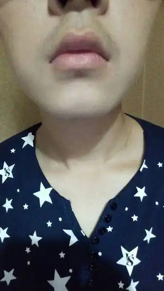 下巴为什么会有一条线,我的下巴骨中间凹进去的,瘦了下巴可以变平吗?