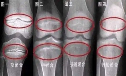 父母都不高女儿15岁时身高却达到178厘米奶奶的做法引人夸赞