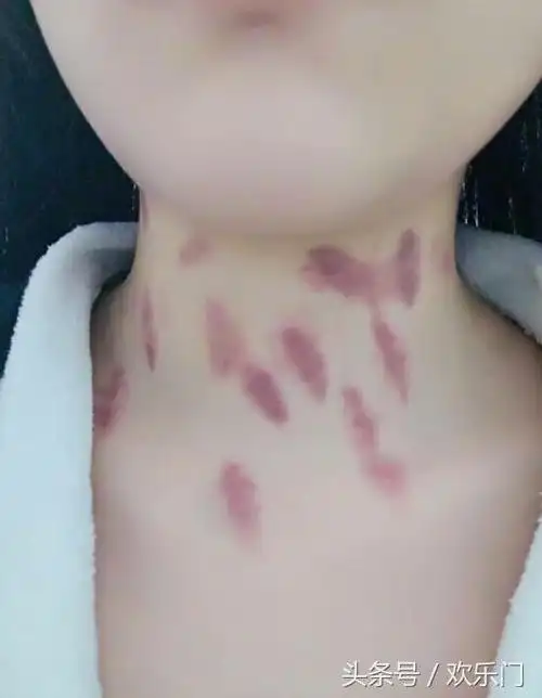 张柏芝晒自拍像20岁少女脖子上的草莓太抢镜