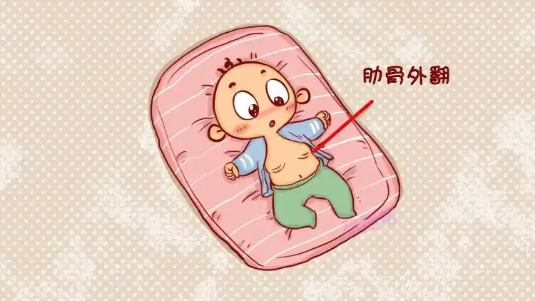 婴儿肋骨外翻图片(造成婴幼儿"肋骨外翻"的三大原因,两条都与妈妈有关