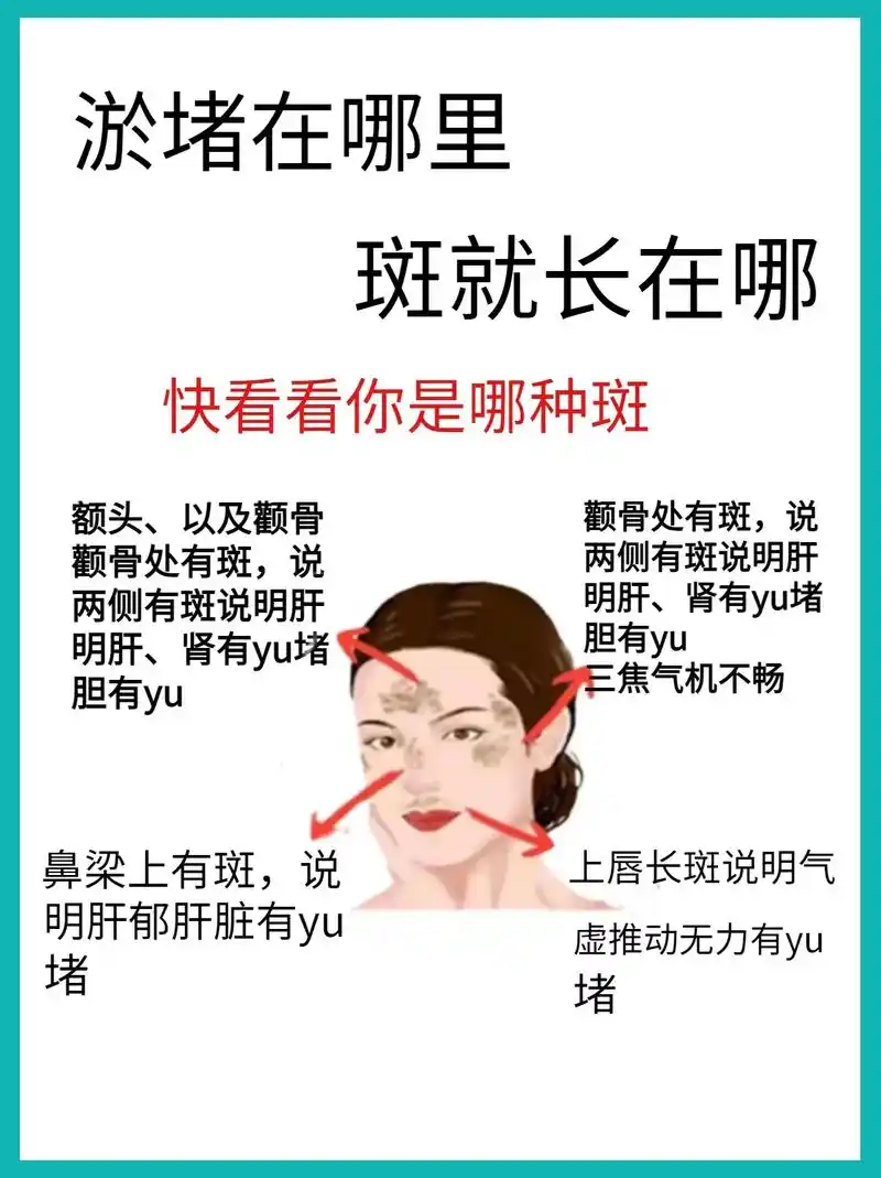 淤堵在哪71斑就在哪7515刷到的建议收藏哦75.