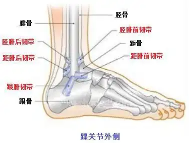 踝关节扭伤别大意,小心外侧副韧带损伤|损伤|韧带|踝关节|-健康界