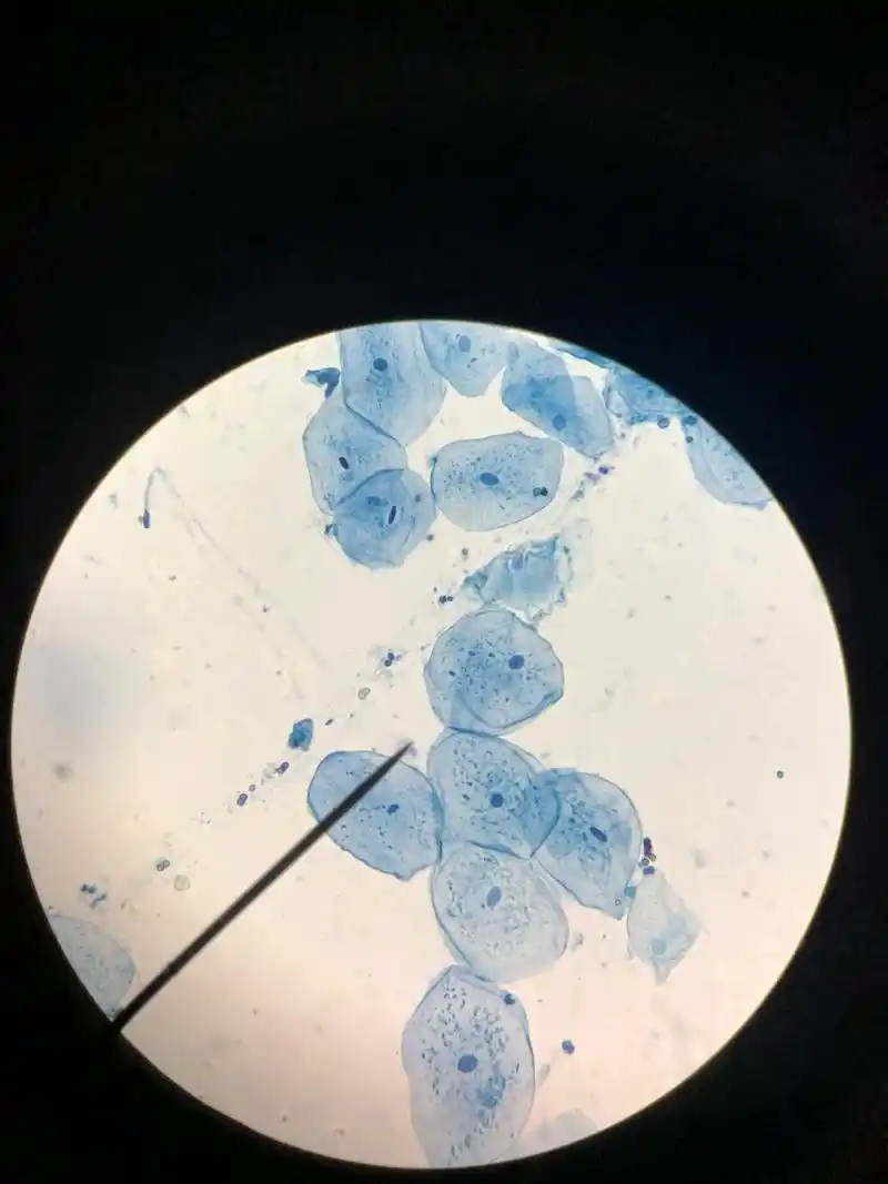 人口腔上皮细胞 实验材料:人口腔上皮细胞 用詹姆斯绿b染液对其进行