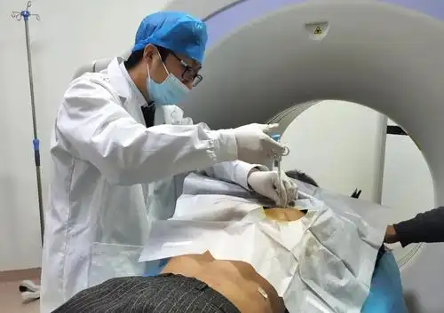 原创福州国德医院肿瘤科成功开展穿刺活检微波消融治疗术